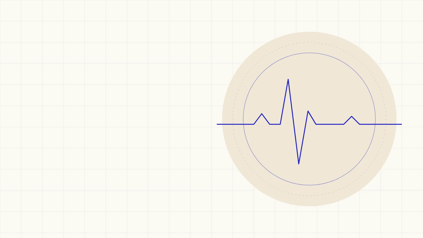 Stylised heart trace, illustrating patent litigation in medical devices